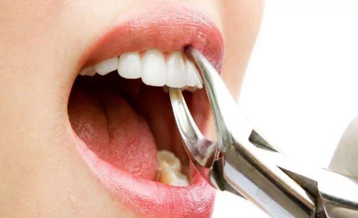 合肥看牙去哪个医院，拔牙前需要做什么