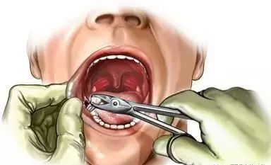 合肥比较靠谱的口腔医院，为什么会牙痛